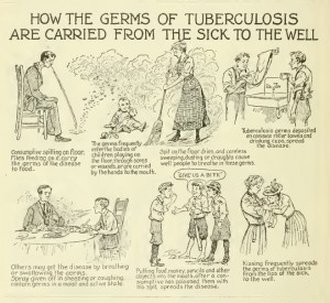 Old Tuberculosis