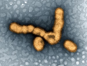 Influenza H1N1 Virus Particles